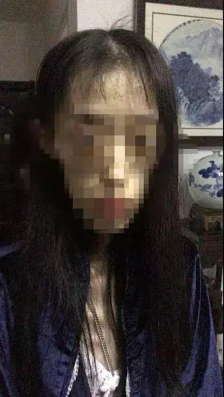 惊！女大学生224斤暴瘦110斤，减掉半个自己背后的辛酸与奇迹！